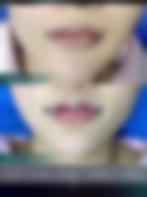 济南俏嘉丽整形医院患者评价