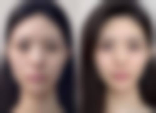 南京奥利维亚整形医院交通路线与预约