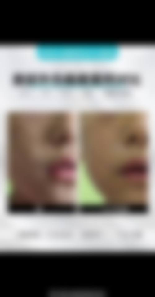 广州雅贝壹医疗美容门诊核心项目