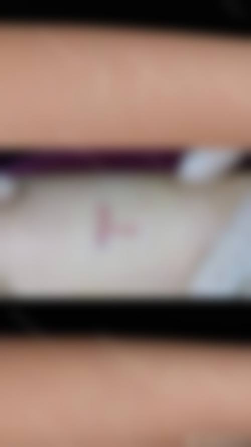 钟盛全患者评价