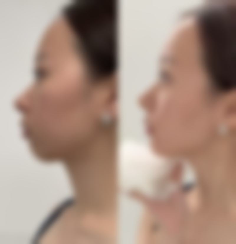 宁波天丽妤美医疗美容诊所患者评价