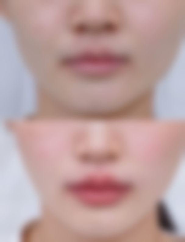 南京奥利维亚整形医院患者评价