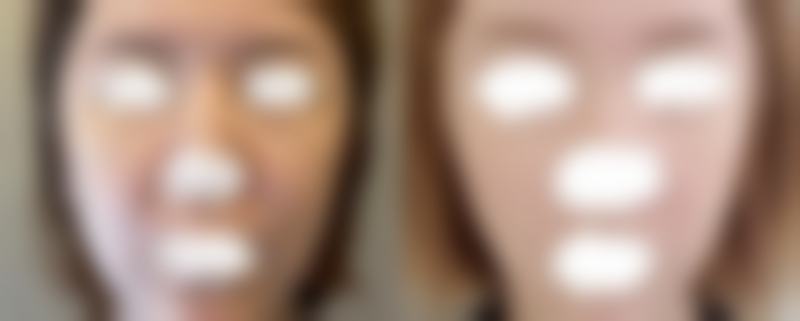 遂宁伊莎贝拉医疗美容门诊部患者评价