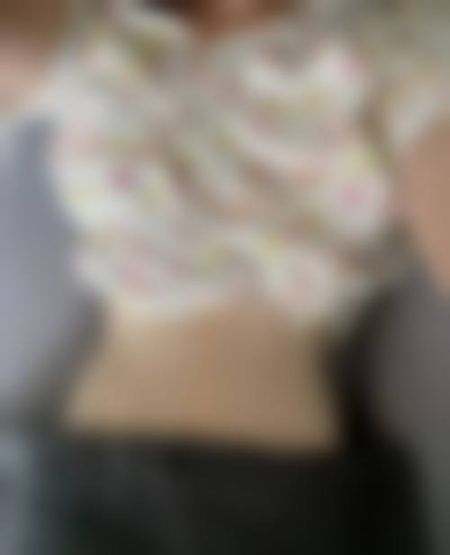 郑州市二七区人民医院激光整形美容中 心核心项目