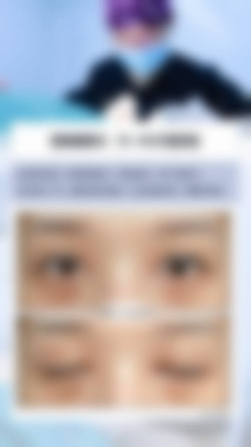 东莞南城汇美整形医疗美容门诊部患者反馈