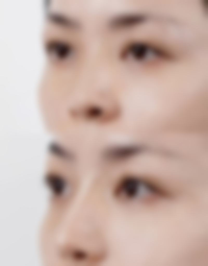 昆明澳斯卡医疗美容门诊部价格参考