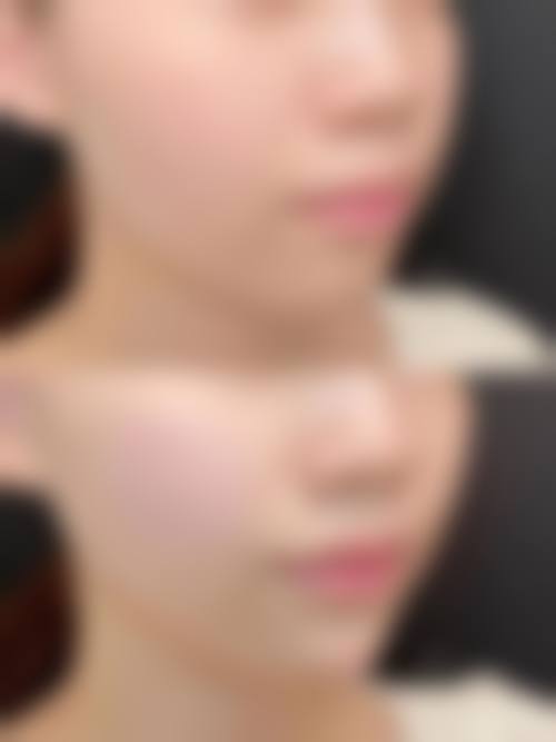 吉林亚太医疗美容医院价格参考