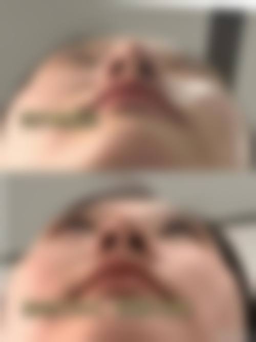 仙桃悦美医疗美容门诊部核心项目