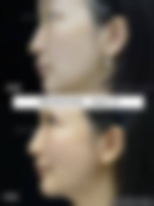 仙桃悦美医疗美容门诊部患者评价