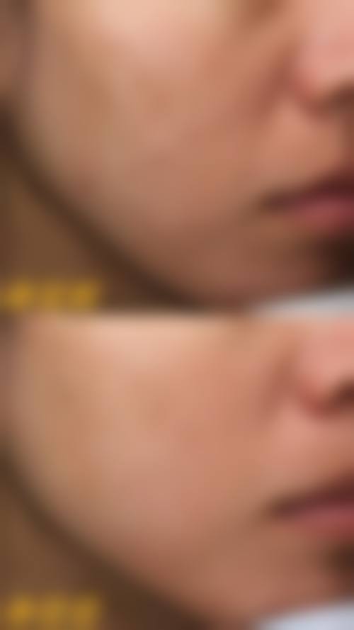 大理丽优美整形医院患者评价