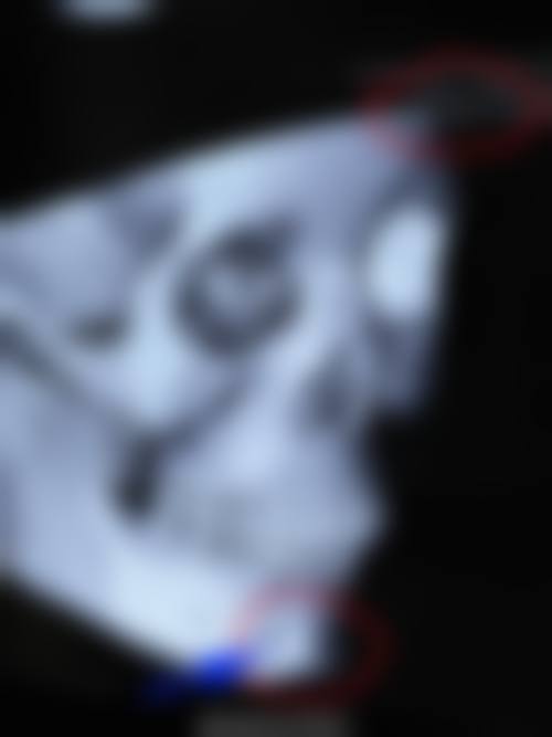 昆明源后壹美整形诊所交通路线与预约