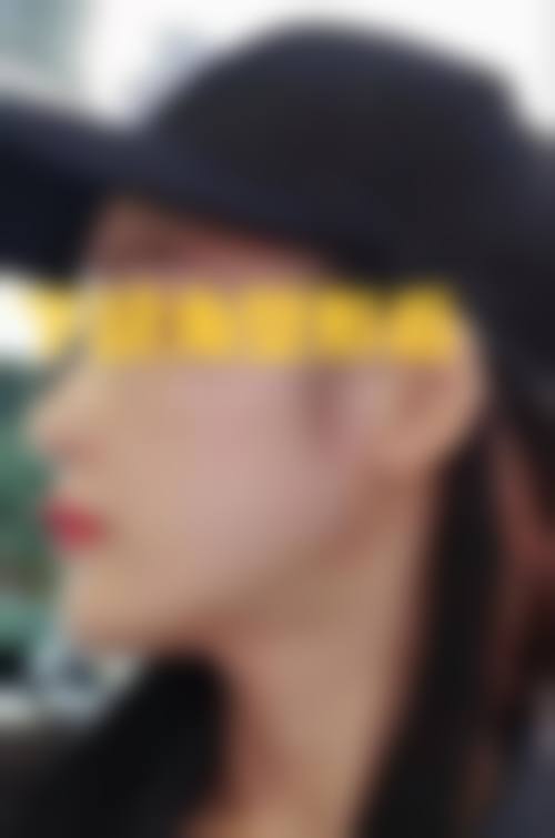 广东佛山市第二人民医院整形外科价格参考