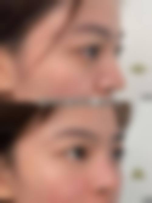 哈尔滨优漾整形医疗美容门诊部价格参考