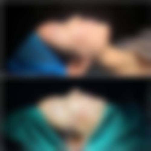 哈尔滨优漾整形医疗美容门诊部患者评价