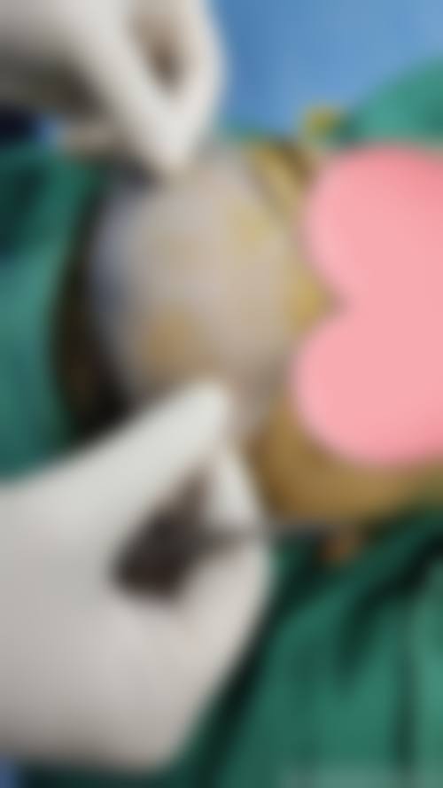 南昌华瑞医疗美容医院价格参考