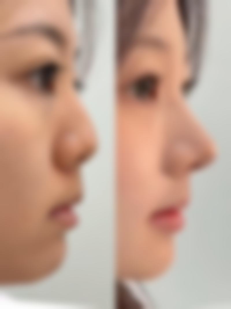 邵阳曹家医疗美容医院患者评价