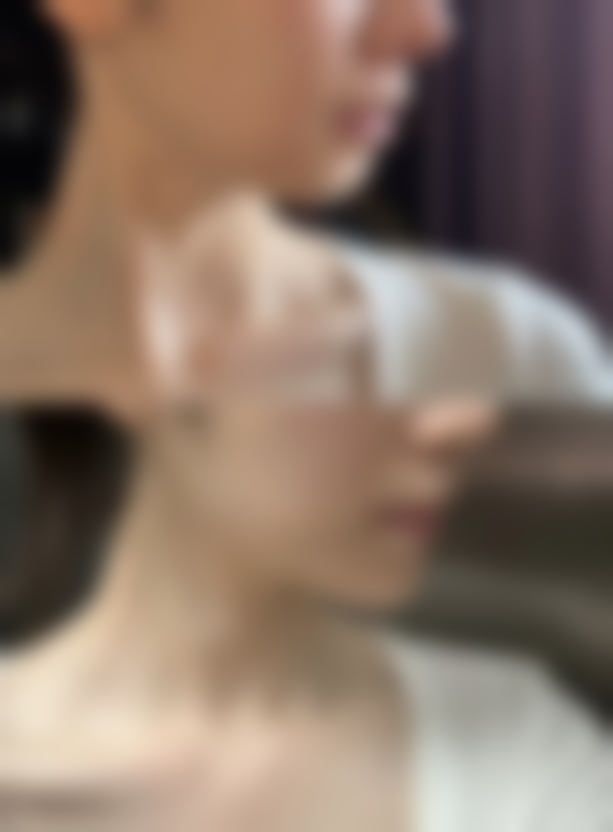 武汉华夏医院激光美容整形中 心价格参考