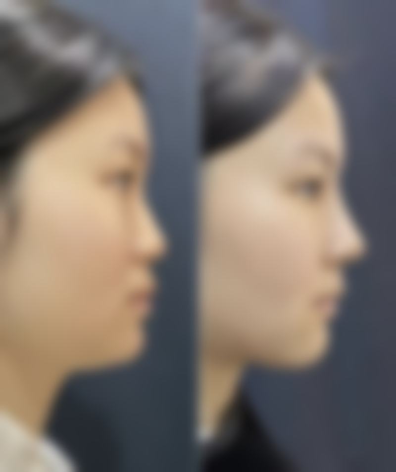 台州椒江伊佳诺医疗美容诊所价格参考