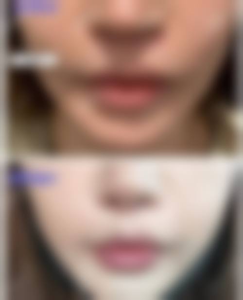 吉林海茵医疗美容诊所患者评价