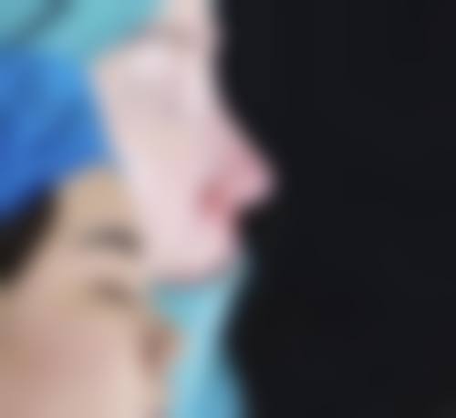 Cocoline整形外科患者评价