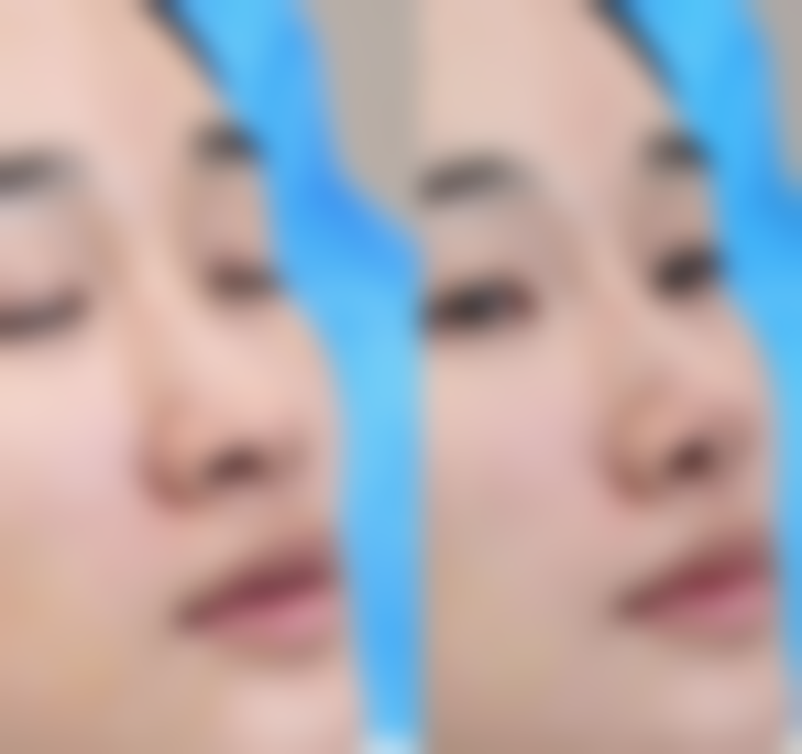 西安春禾整形医院价格参考