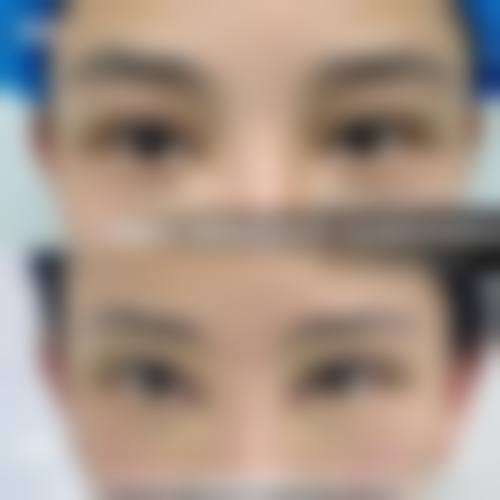 瑞安出色臻美整形医院患者评价