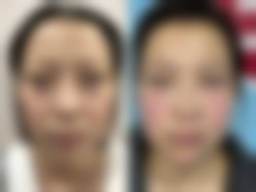 徐州亚韩医疗美容门诊部患者评价