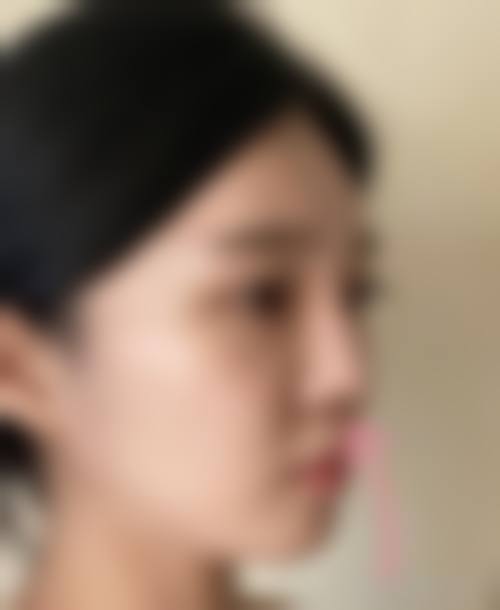 乐清顾得美医疗美容诊所价格参考