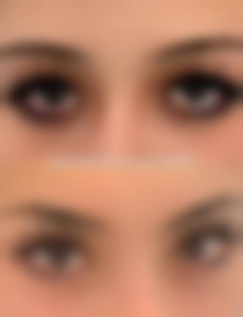 韩国pure皮肤科医院核心项目