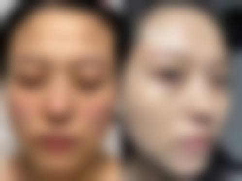 新疆乌鲁木齐美妍医疗美容诊所价格参考