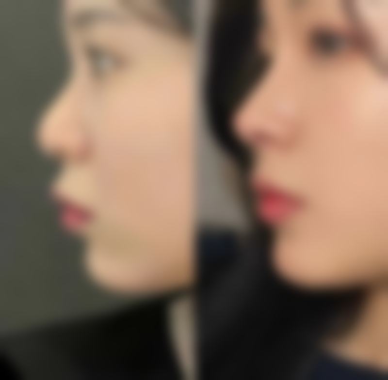 孟庆鹏技术水平评价