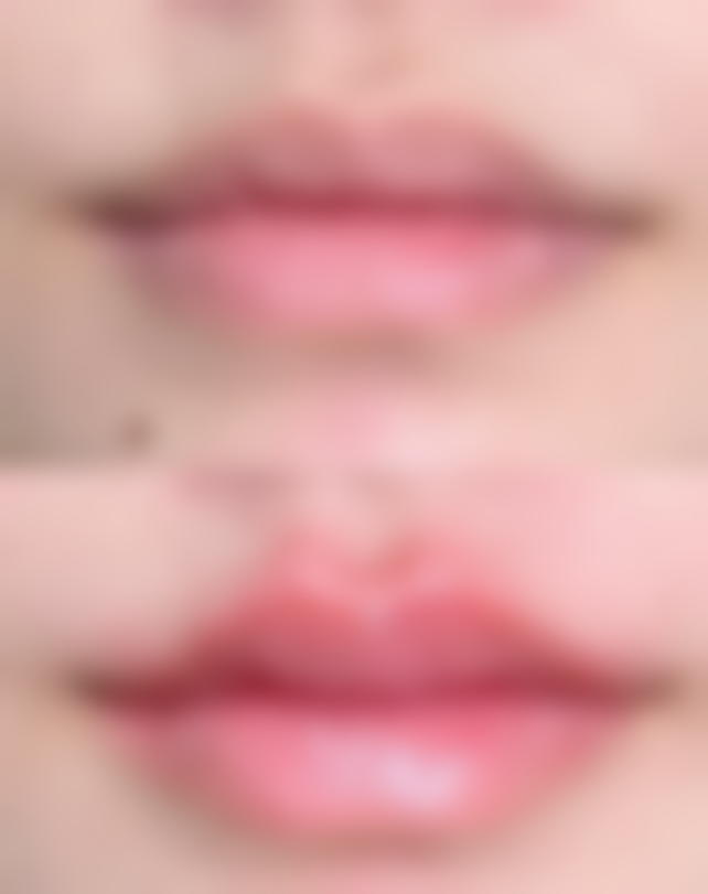 宁德新颜至美整形医院价格参考