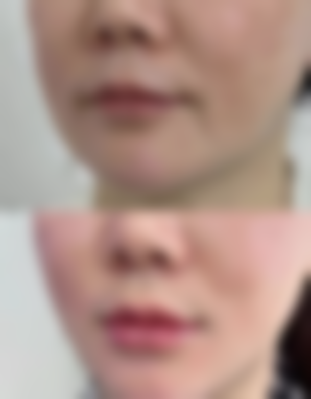 宁德新颜至美整形医院患者反馈