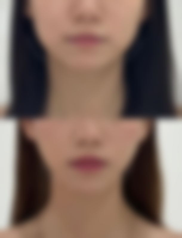 瑞安出色臻美整形医院核心项目