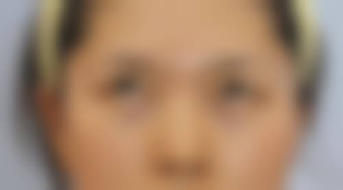 西安庄臣新生整形医院患者评价