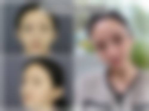 浙江绿城医院整形美容机构求美者反馈