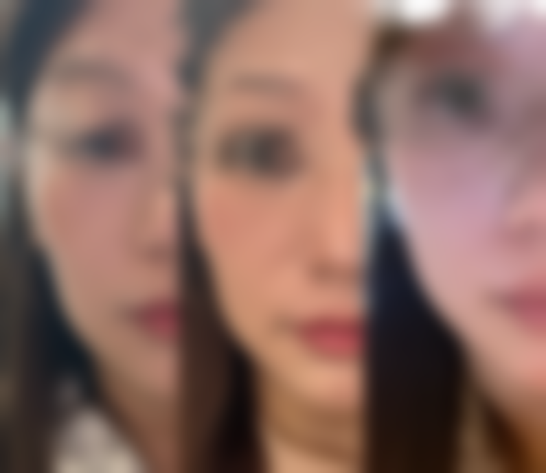 西安庄臣新生整形医院正规资质