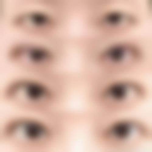 西安雅颜尚尊整形医院患者评价