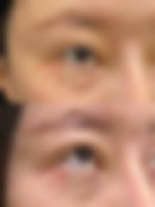 西安雅颜尚尊整形医院核心项目