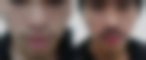 常德凯尔美斯医疗美容医院核心项目