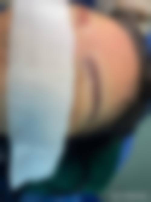 深圳星颜医疗美容医院价格参考