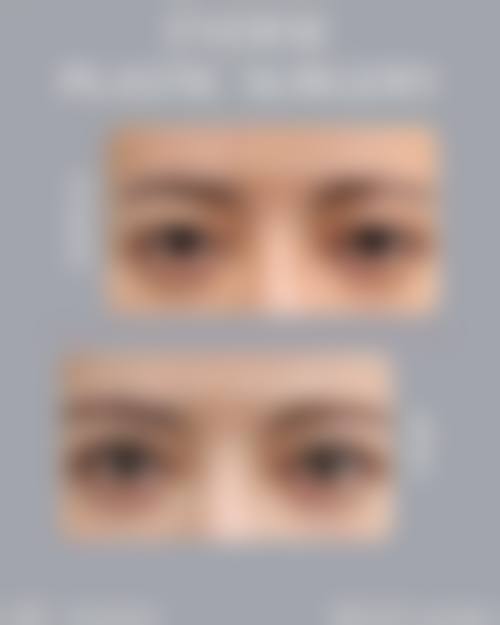 济南原纯医疗美容正规资质