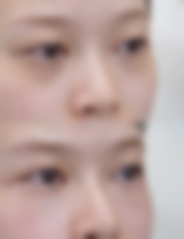 杭州艺美紫馨医疗美容诊所价格参考