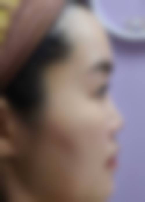 义乌市中 心医院(烧伤整形科)价格参考