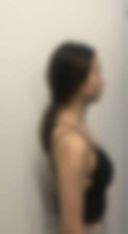 开原兰森整形医院核心项目