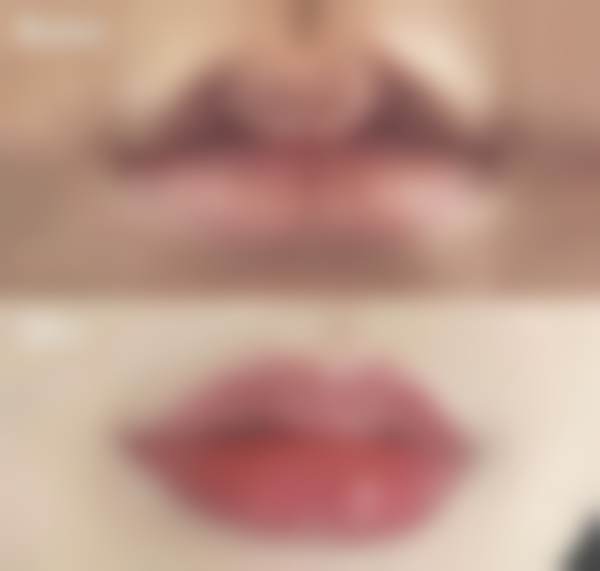 韩国Moon皮肤科医院交通路线与预约