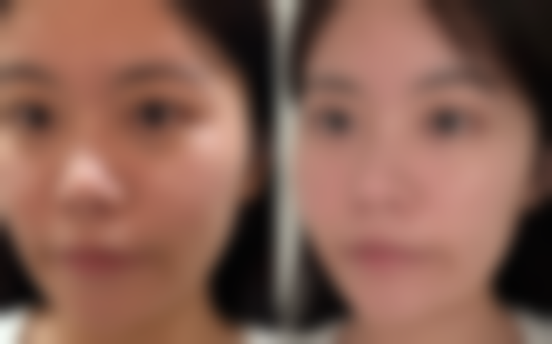 吴学田患者评价