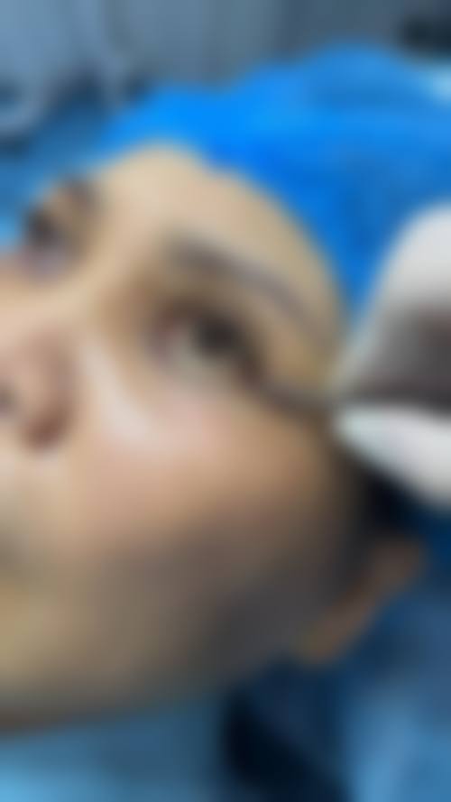 心美眼整形外科患者评价