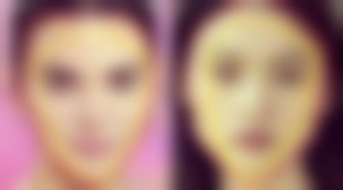 韩国BY整形外科患者评价