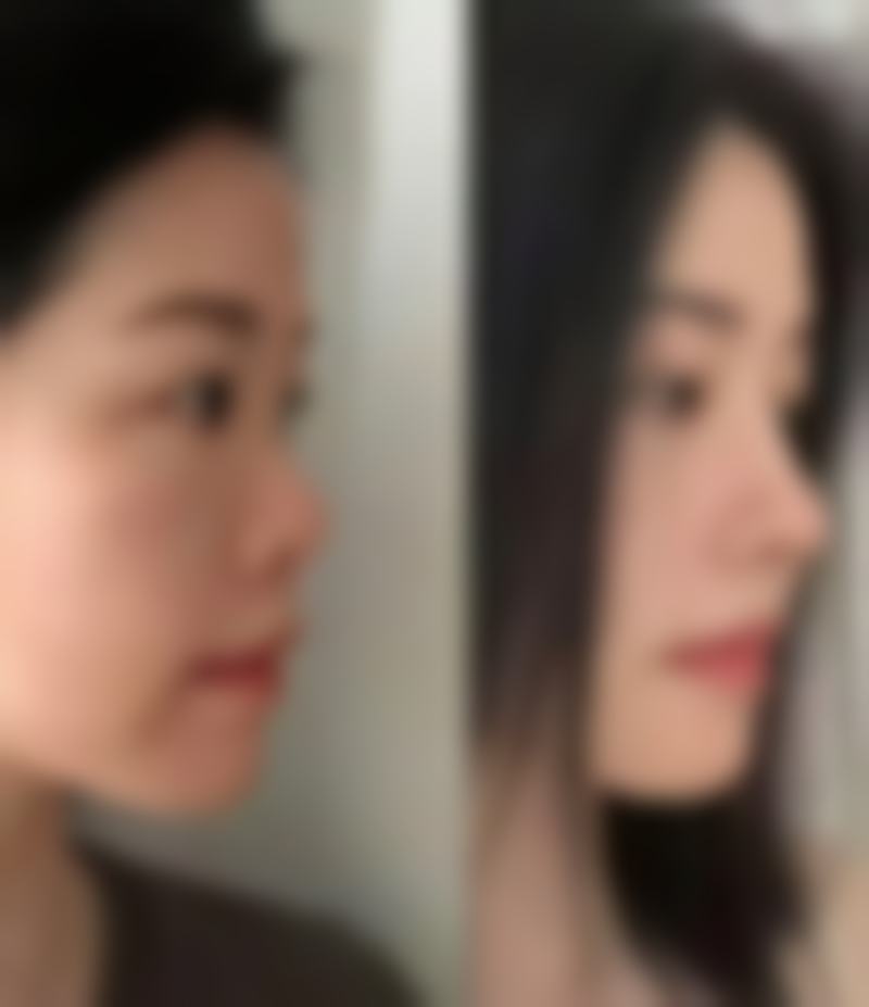 KIBBUM整形医院核心项目